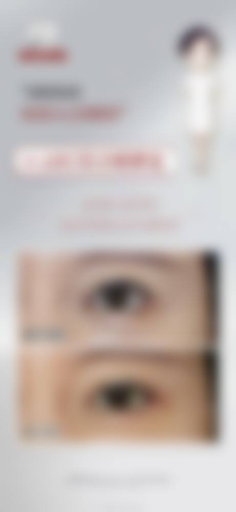 冯少清复杂瘢痕畸形修复实例