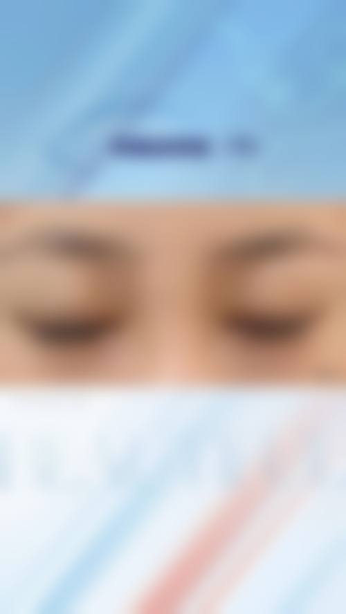 冯少清复杂瘢痕畸形修复水平怎么样可靠吗？