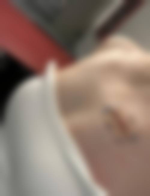 冯少清复杂瘢痕畸形修复水平怎么样可靠吗？