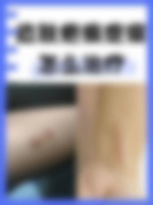 冯少清复杂瘢痕畸形修复水平怎么样可靠吗？