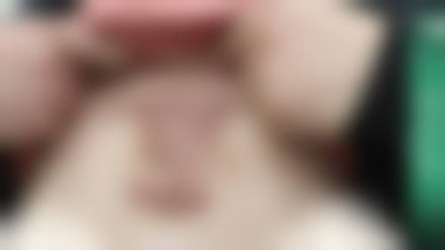 冯少清复杂瘢痕畸形修复实例