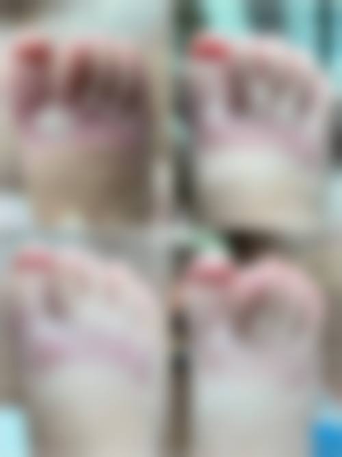 冯少清复杂瘢痕畸形修复水平怎么样可靠吗？