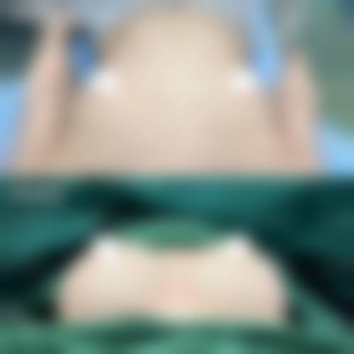 冯少清项目价格表参考