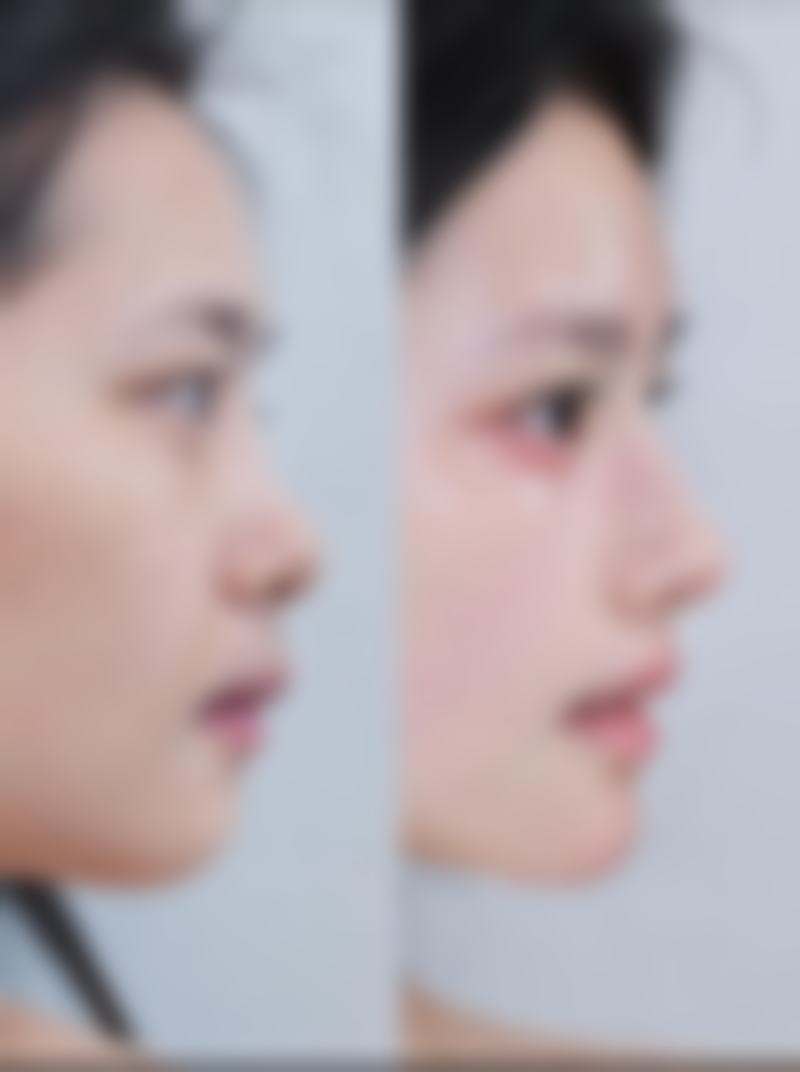 七、韩国The slim整形医院真实的顾客评价如下：