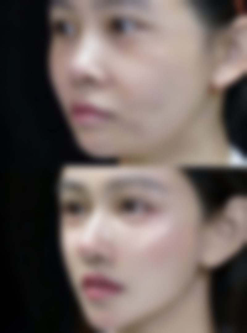 修复手术情况分析，解决宽窄不一难题