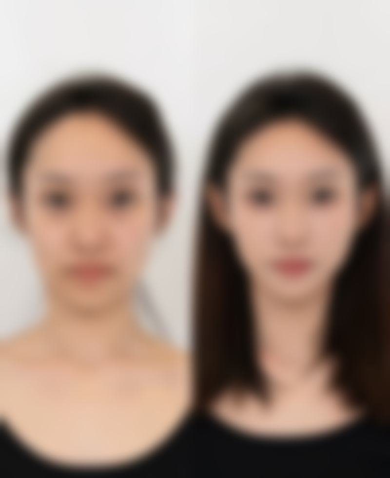 七、延吉市亚细亚医疗美容门诊部真实的顾客评价如下：