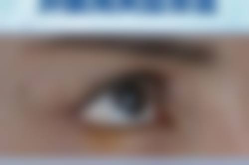 具有影响力医院护航：全方面保护你的瘦脸之旅