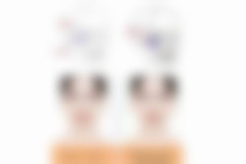 假体隆胸后喂奶究竟会不会下垂？下垂后的改善方法