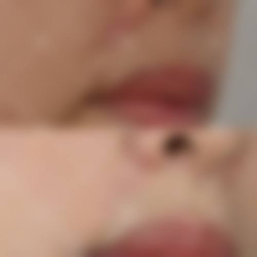 冯少清复杂瘢痕畸形修复水平怎么样可靠吗？