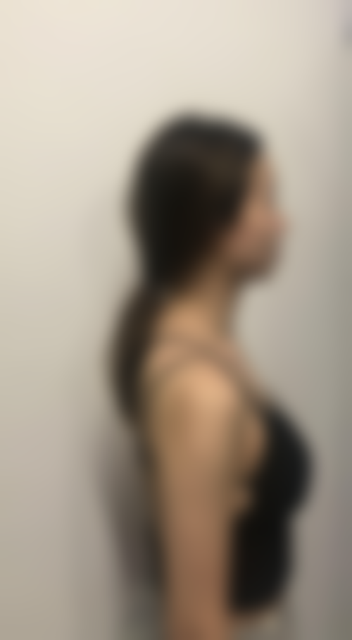 黎秋生烧伤创面修复水平怎么样可靠吗？