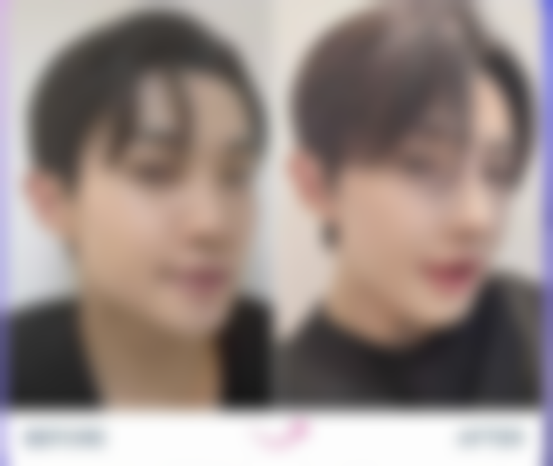 早期护理:打好淡化疤痕基础