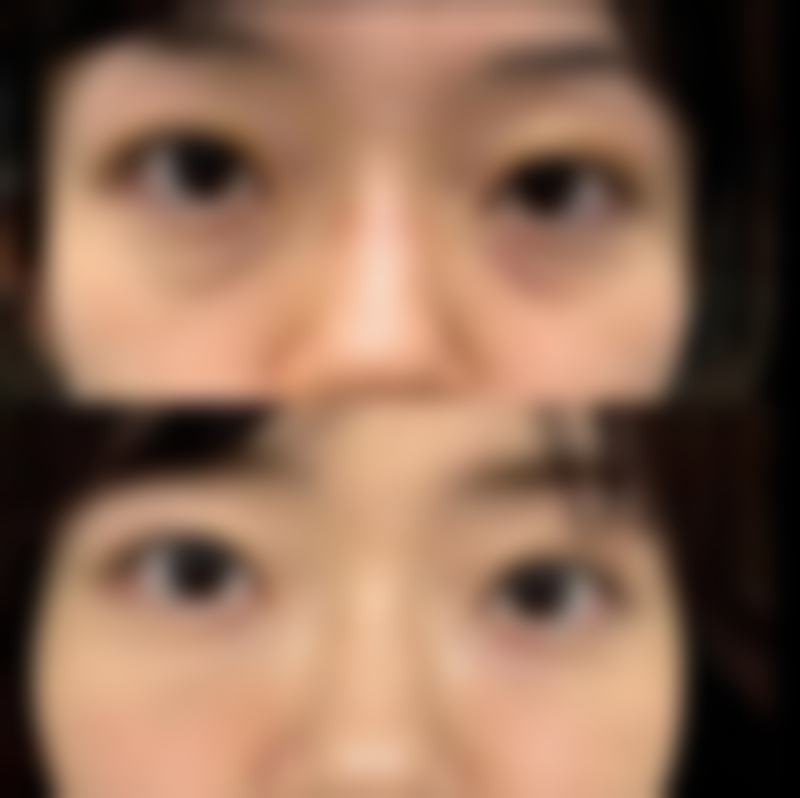 热油烫伤留疤别烦恼！家庭护理来帮忙