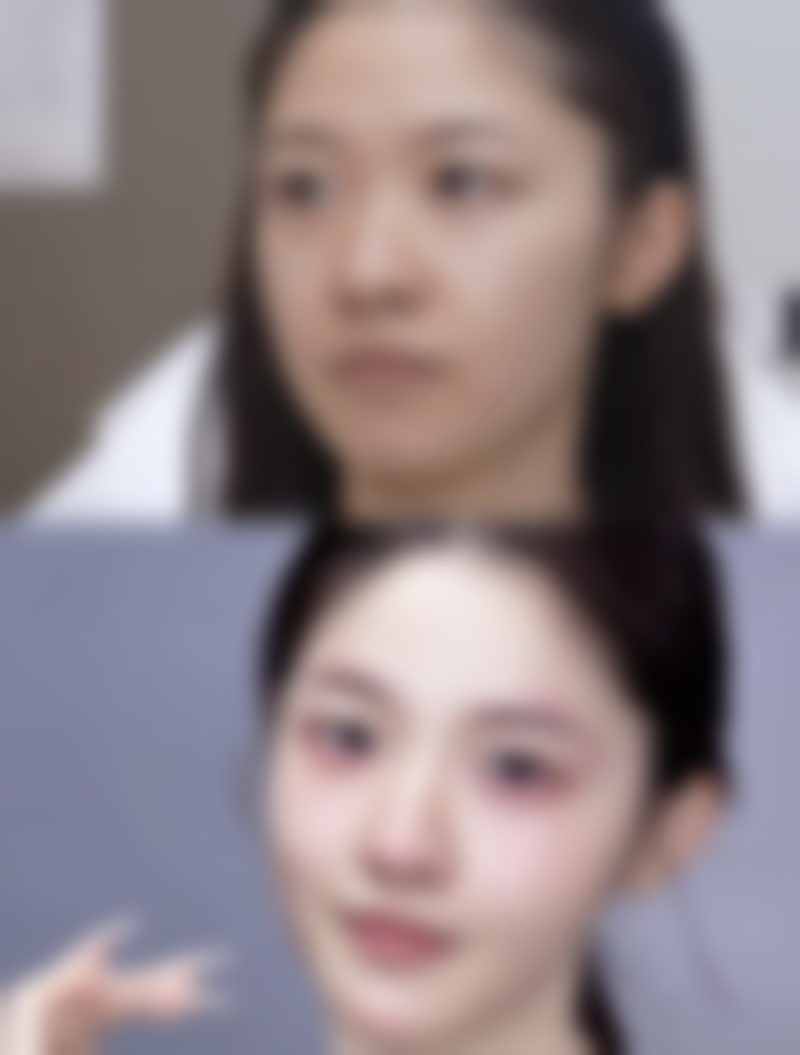 五、东莞万江研多萃整形医院实例