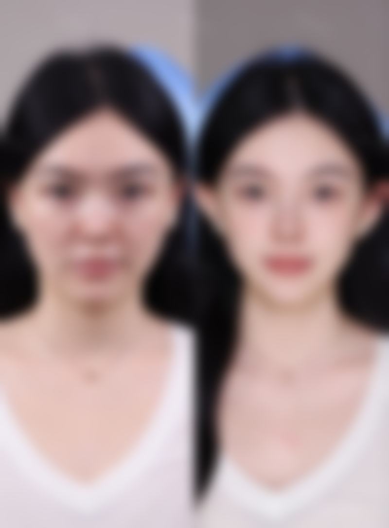 五、广州芬娜诗医疗美容门诊部怎么预约: