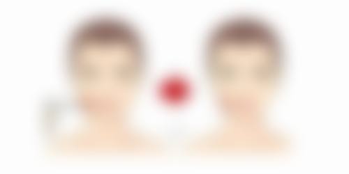 五、南昌禾丽医疗美容整形医院怎么预约：