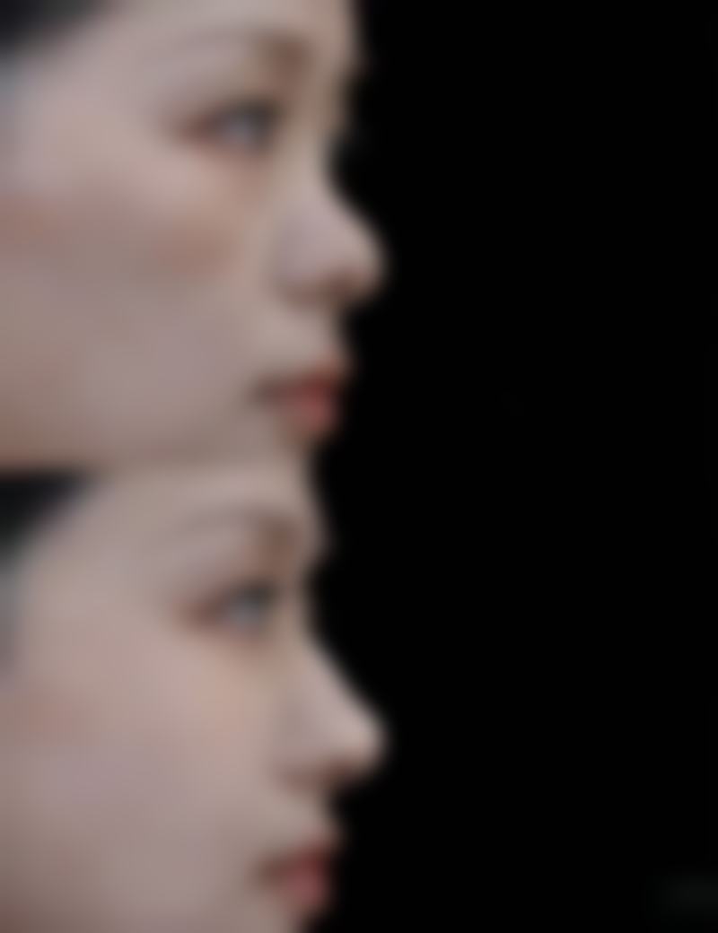 如何搞定疤痕后的色素沉淀？医美联合护理，助你肤色回归均匀透亮 