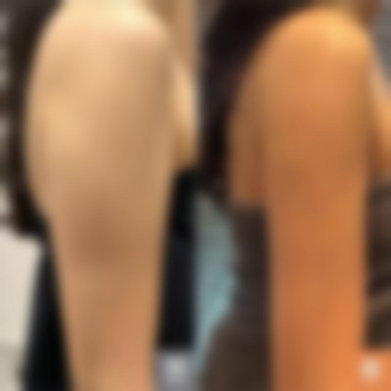 七、新疆威兹曼（原新疆整形）美容医院真实的顾客评价如下：