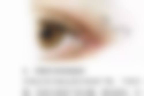 还不知道咋选？了解一下费用和风险