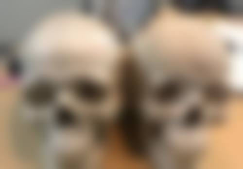 优质医院推荐：让你的瘦脸之旅更安心！