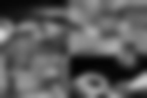 瘦脸针注射后的注意事项