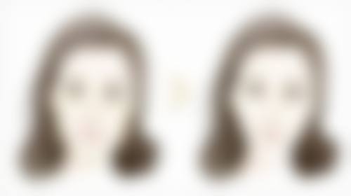 医院选择:为瘦脸针注射保驾护航