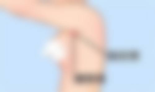 五、韩国狎鸥亭延世整形外科实例