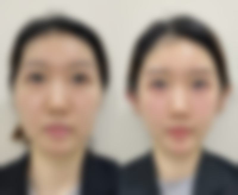 七、洪湖朝颜整形医院真实的顾客评价如下：