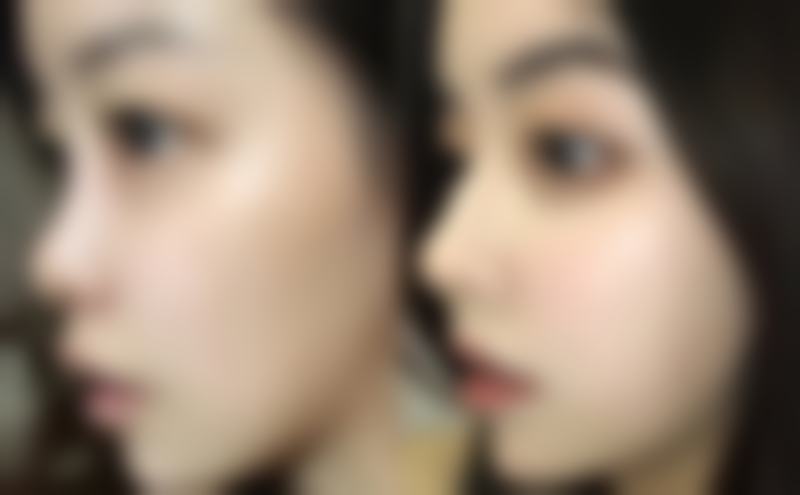 七、武汉宛如星生整形医院真实的顾客评价如下：