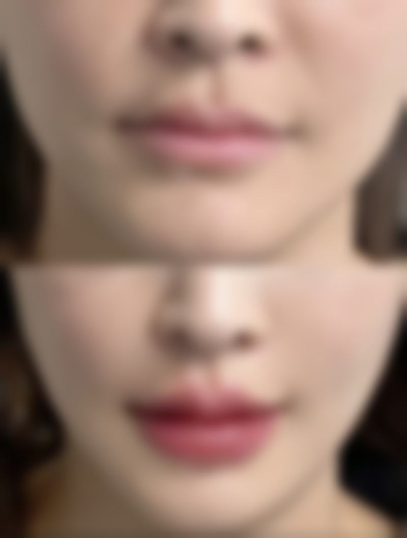 二、南医 大友谊整形扬州医疗美容门诊部正规吗？来看看医院资质：