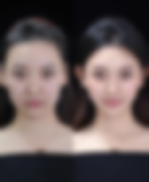 眼部按摩仪的实际作用大揭秘