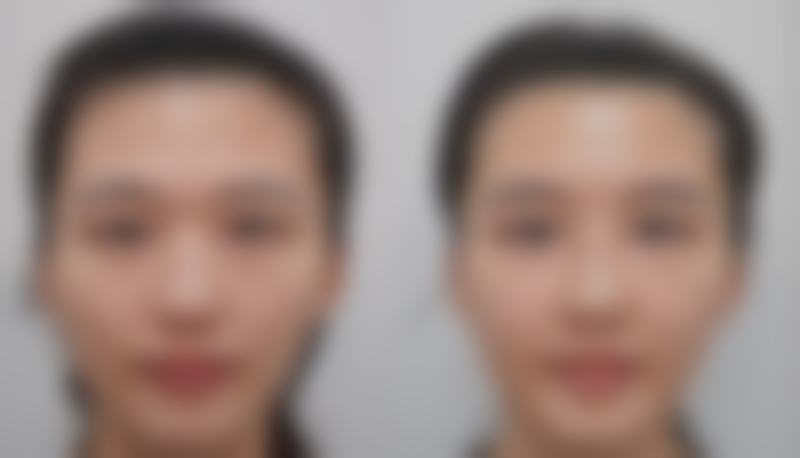 五、南医 大友谊整形扬州医疗美容门诊部怎么预约：