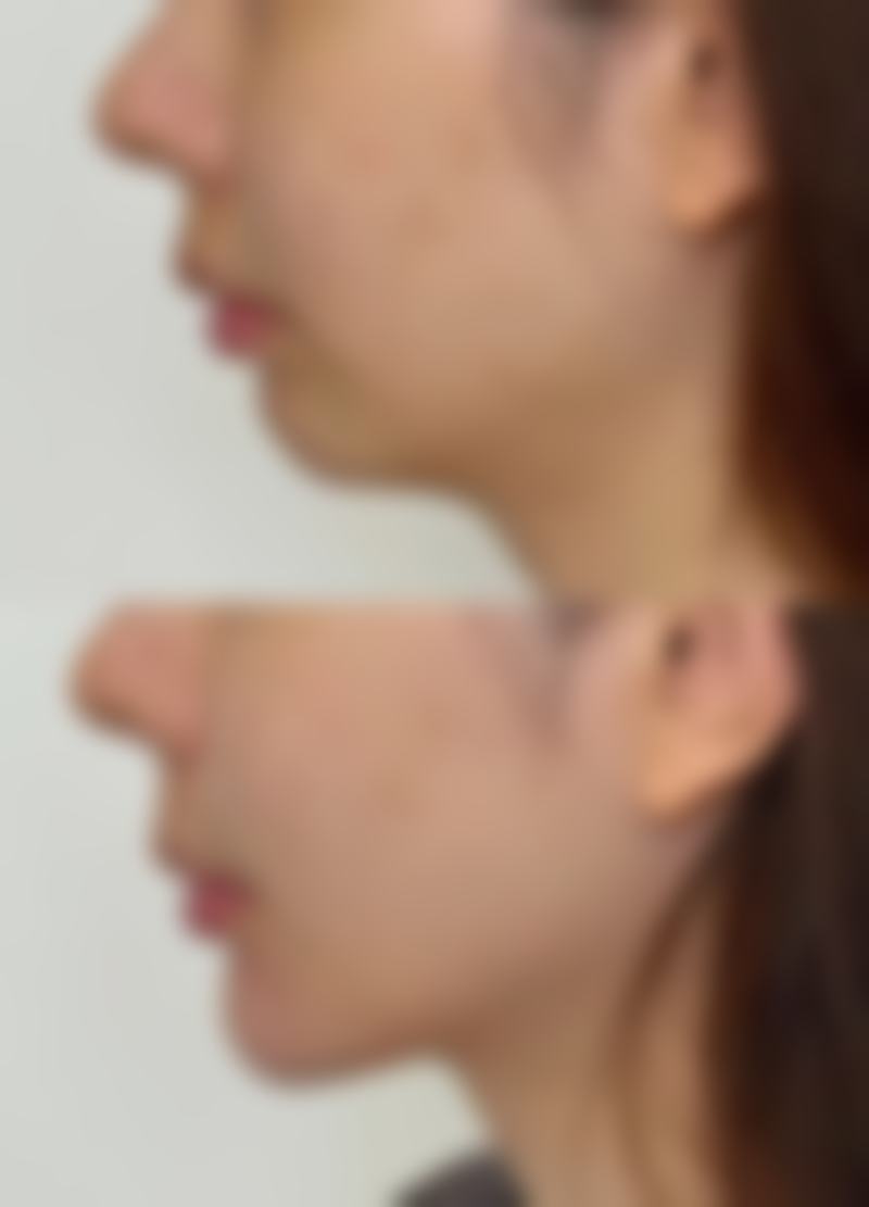 六、韩国Theia皮肤科医院价格表：（仅供参考）