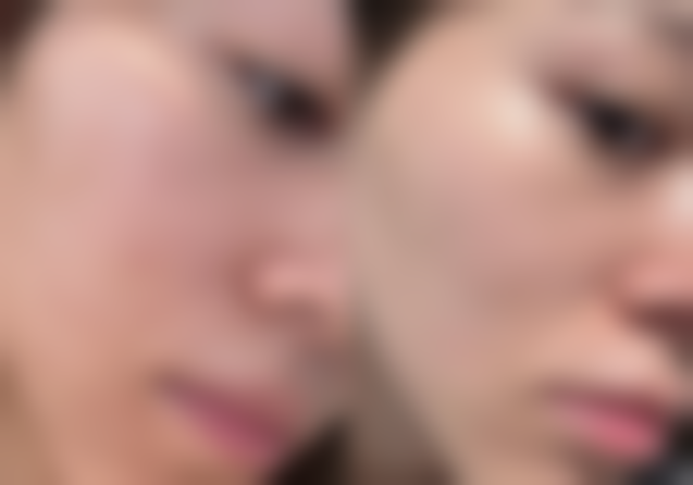 还在犹豫怎么选？看看修复时间