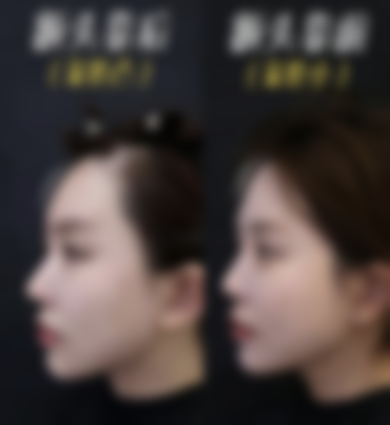 七、唐山真善美（原美仁）医疗美容诊所真实的顾客评价如下：