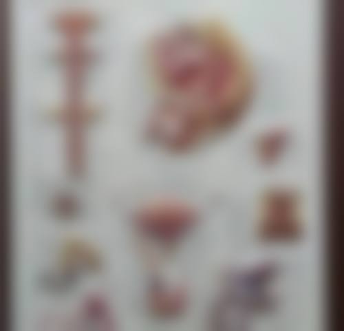 四、韩国SEHYUN整形外科实例