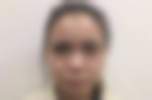 医院综合信息,让你祛眼袋更放心