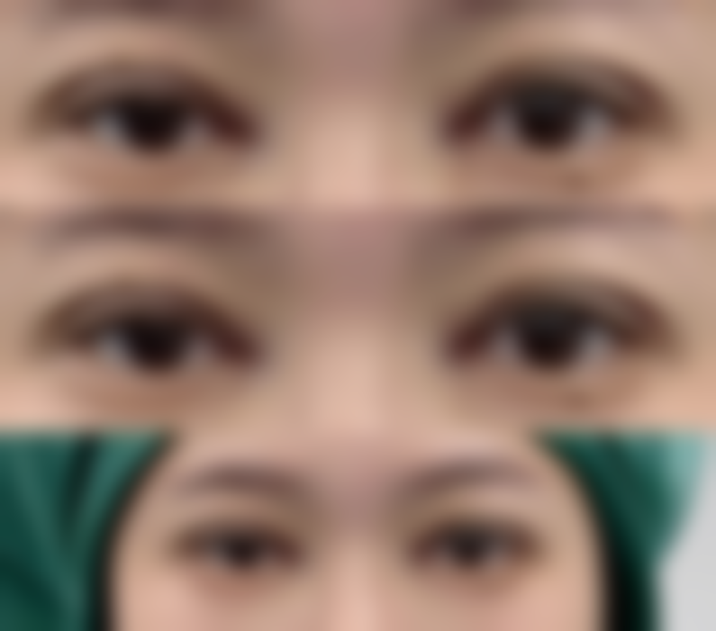 工伤面部留疤别急,医院技术实力强