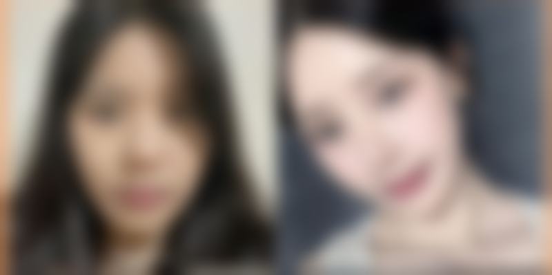 至佳手术时机，你选对了吗？