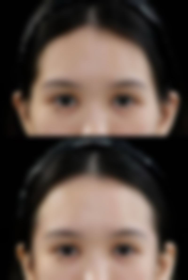 工伤面部留疤不怕,理赔流程要清楚