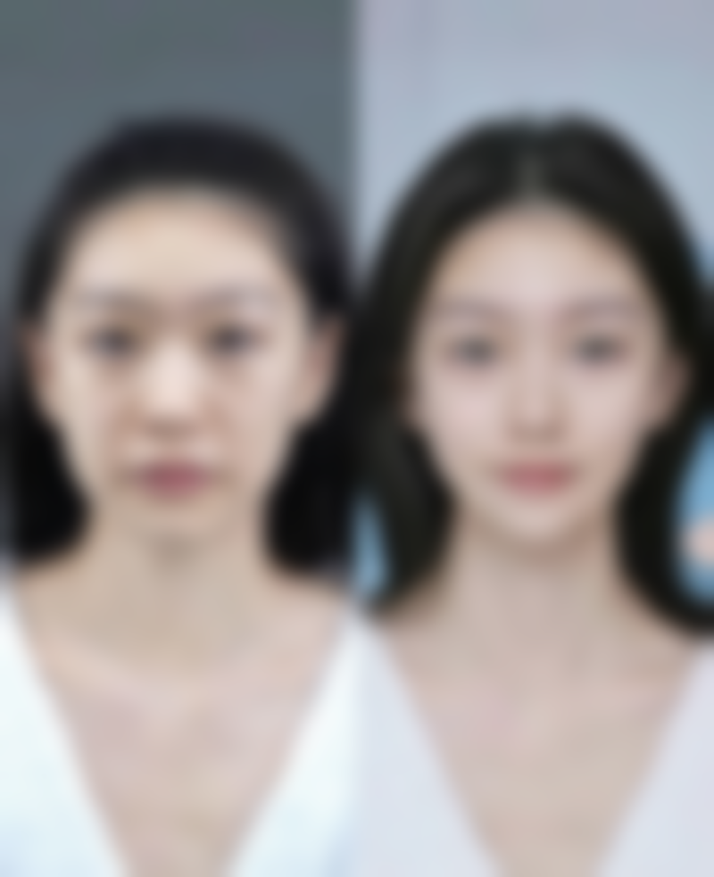 不选经期割双眼皮，好处多多