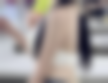 生理期割双眼皮可行吗？了解经期风险与最佳时机，安全变美更无忧