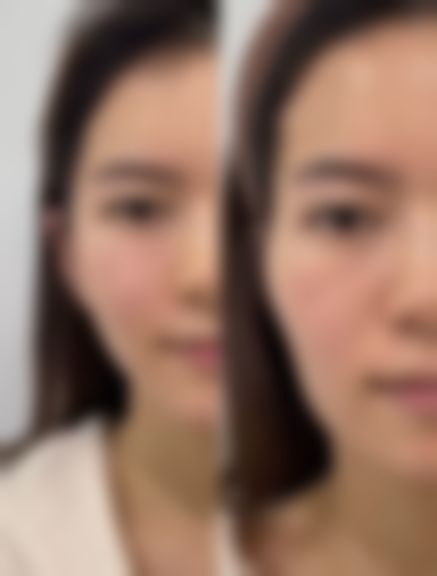 工伤面部留疤别忧,医院环境设施佳