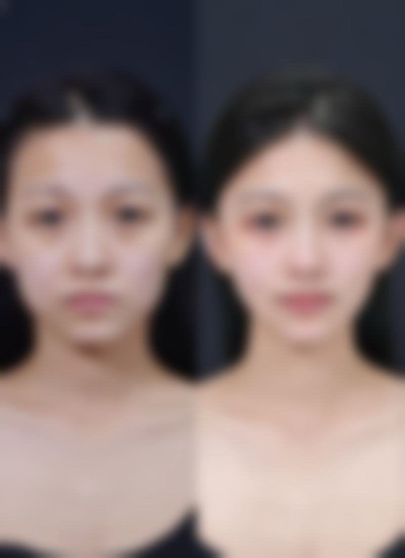 六、成都博仁圣缇雅(新颐美)医疗美容门诊部怎么预约: