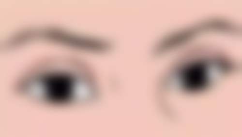 总结:选对去眼袋产品,告别眼袋烦恼