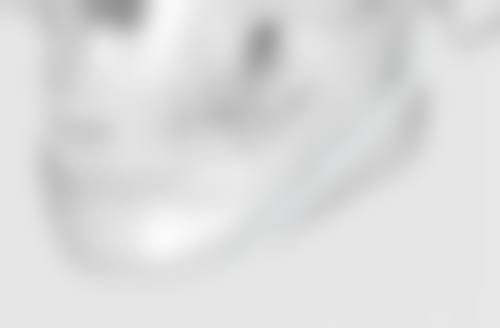 如何去除双眼皮白色疤痕？公立三甲医院多元方案，精准修复还你自然美目 