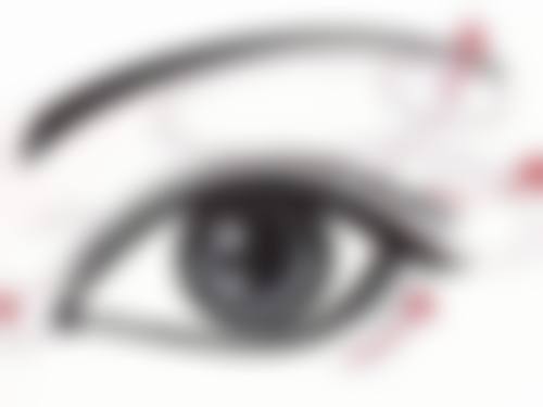 隆胸后腋下疤痕不同阶段咋护理?加速美观蜕变秘籍