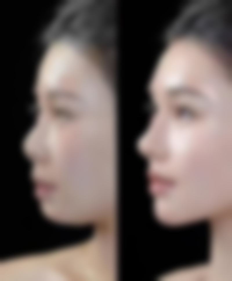 四、西安侈迷儿医疗美容诊所实例