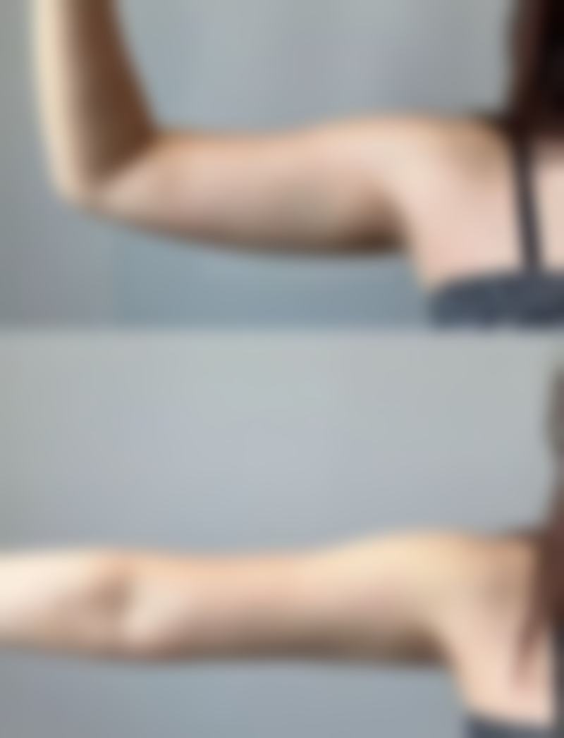 选择正规医院，收获美丽与安心