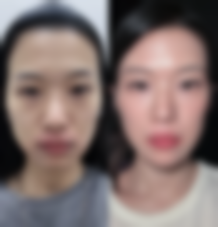 七、合肥瑞皙植发医院价格表:(仅供参考)