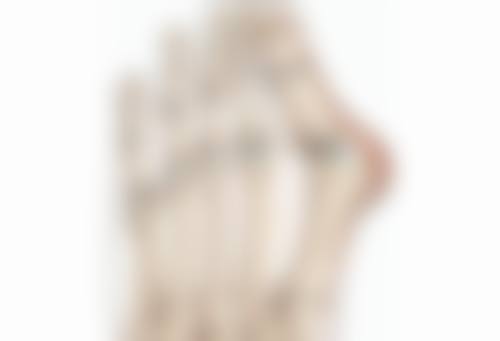 怎样让双眼皮快速消肿？日常注意事项要牢记